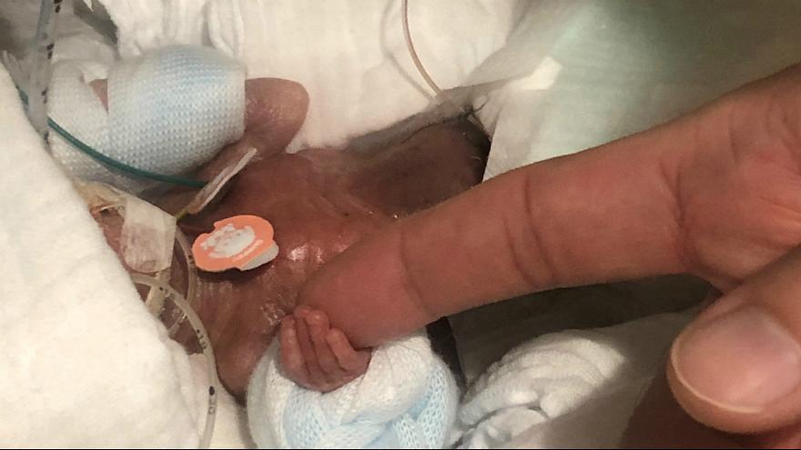 کوچکترین نوزاد پسر جهان، سالم از بیمارستان مرخص شد
